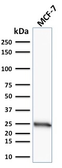 Anti-Bcl-2 antibody [100/D5] used in Western Blot (WB). GTX34425