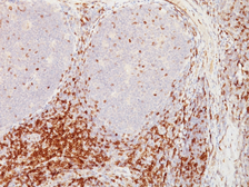 Anti-CD5 antibody [CD5/54/F6] used in IHC (Paraffin sections) (IHC-P). GTX34526