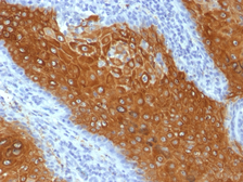 Anti-Cytokeratin 10 antibody [KRT10/844] used in IHC (Paraffin sections) (IHC-P). GTX34625