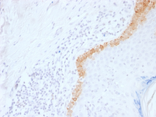 Anti-Cytokeratin 15 antibody [LHK15] used in IHC (Paraffin sections) (IHC-P). GTX34632