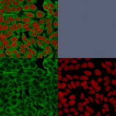 Anti-Fascin 1 antibody [FSCN1/416] used in Immunocytochemistry/ Immunofluorescence (ICC/IF). GTX34717
