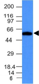 Anti-Fascin 1 antibody [FSCN1/417] used in Western Blot (WB). GTX34718