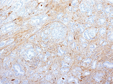 Anti-Fibronectin antibody [SPM539] used in IHC (Paraffin sections) (IHC-P). GTX34726