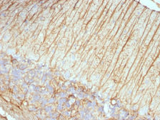 Anti-GFAP antibody [ASTRO/789] used in IHC (Paraffin sections) (IHC-P). GTX34758