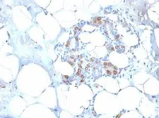 Anti-HSP27 antibody [SPM252] used in IHC (Paraffin sections) (IHC-P). GTX34782