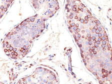 Anti-MAGE 1 antibody [SPM282] used in IHC (Paraffin sections) (IHC-P). GTX34810