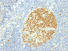 Anti-MCM7 antibody [MCM7/1469] used in IHC (Paraffin sections) (IHC-P). GTX34820
