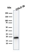 Anti-Melan A antibody [rMLANA/788] used in Western Blot (WB). GTX34824
