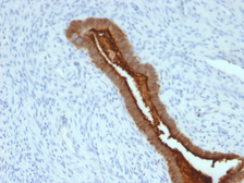 Anti-MUC1 antibody [SPM492] used in IHC (Paraffin sections) (IHC-P). GTX34861