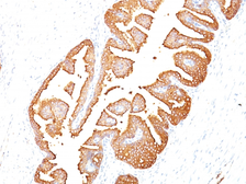 Anti-PSA antibody [KLK3/801] used in IHC (Paraffin sections) (IHC-P). GTX34990