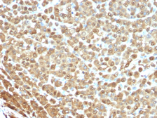 Anti-S100 alpha antibody [S1/61] used in IHC (Paraffin sections) (IHC-P). GTX34997