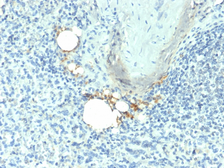 Anti-TRAP antibody [ACP5/1070] used in IHC (Paraffin sections) (IHC-P). GTX35145
