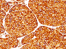 Anti-Tyrosinase antibody [T311] used in IHC (Paraffin sections) (IHC-P). GTX35154