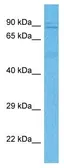 Anti-KIF3B antibody used in Western Blot (WB). GTX35189