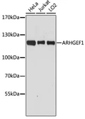 Anti-ARHGEF1 antibody used in Western Blot (WB). GTX35236