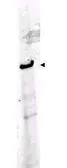 Anti-ROBO1 antibody used in Western Blot (WB). GTX36928