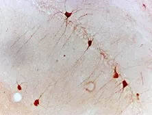 Anti-Netrin 1 antibody used in IHC (Paraffin sections) (IHC-P). GTX37361