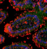 Anti-GM-CSF Receptor alpha antibody used in IHC (Paraffin sections) (IHC-P). GTX37684
