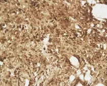 Anti-beta 2 Defensin antibody used in IHC (Paraffin sections) (IHC-P). GTX37716