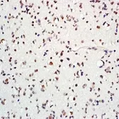 Anti-ASCL1 antibody used in IHC (Paraffin sections) (IHC-P). GTX37779
