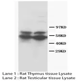 Anti-RUNX2 antibody used in Western Blot (WB). GTX38531