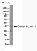 Anti-Cardiac Troponin T antibody [TT44 (BGN/1288/44)] used in Western Blot (WB). GTX38867