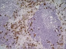 Anti-Ly-6B.2 antibody [7/4] used in IHC (Frozen sections) (IHC-Fr). GTX39795