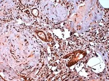 Anti-Estrogen Receptor beta 5 antibody [5/25] used in IHC (Paraffin sections) (IHC-P). GTX41209
