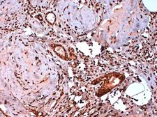 Anti-Estrogen Receptor beta 5 antibody [5/25] used in IHC (Paraffin sections) (IHC-P). GTX41212