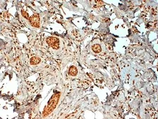 Anti-Estrogen Receptor beta 2 antibody [57/3] used in IHC (Paraffin sections) (IHC-P). GTX41214