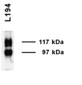 Anti-UT-A1 antibody used in Western Blot (WB). GTX41973