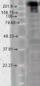 Anti-Nav1.7 antibody [S68-6] used in Western Blot (WB). GTX41995