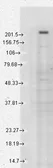 Anti-TRPM7 antibody [S74-25] used in Western Blot (WB). GTX41997
