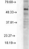 Anti-GABA A Receptor delta antibody [S151-3] used in Western Blot (WB). GTX42024