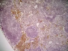 Anti-Mannose Receptor antibody [MR5D3] used in IHC (Frozen sections) (IHC-Fr). GTX42263