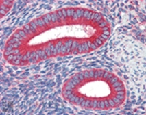 Anti-Calreticulin antibody [FMC 75] used in IHC (Paraffin sections) (IHC-P). GTX42683