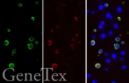 SARS-CoV-2 (COVID-19) Spike S1 FFPE 293T cell pellet block. GTX435643