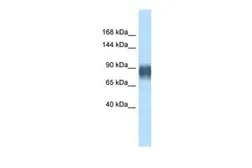 Anti-Advillin antibody, N-term used in Western Blot (WB). GTX44605