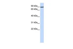 Anti-ATMIN antibody, Internal used in Western Blot (WB). GTX44610