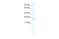 Anti-ASCL2 antibody, C-term used in Western Blot (WB). GTX44645