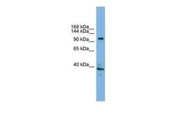 Anti-ATP6V0A1 antibody, C-term used in Western Blot (WB). GTX44653
