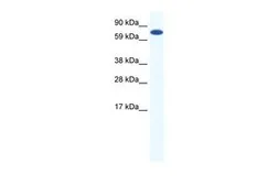 Anti-MTGR1 antibody, Internal used in Western Blot (WB). GTX44661