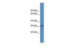 Anti-AUH antibody, N-term used in Western Blot (WB). GTX44673