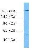 Anti-MRP2 antibody, Internal used in Western Blot (WB). GTX44679