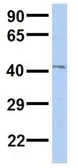 Anti-RP11-217H1.1 antibody, N-term used in Western Blot (WB). GTX44823