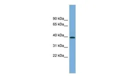 Anti-PLEKHA1 antibody, N-term used in Western Blot (WB). GTX44896