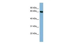 Anti-RIC8B antibody, Internal used in Western Blot (WB). GTX44969