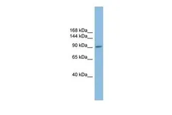 Anti-PIWIL2 antibody, N-term used in Western Blot (WB). GTX44976