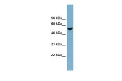 Anti-FAM83E antibody, Internal used in Western Blot (WB). GTX44988