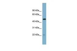 Anti-UCHL5IP antibody, Internal used in Western Blot (WB). GTX44996